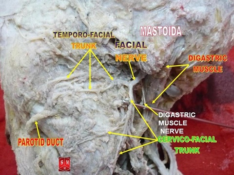 Facial_nerve.jpg Facial_nerve