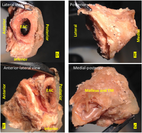 Figure 12 E to G.jpg