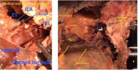 Figure 14-3.jpg