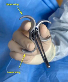 Index finger can be positioned on the upper “wing” of the ergonomic forceps attachment per surgeon’s preference Adjustable ergonomic attachment for surgical forceps with preferred finger position for increased stability comfort during surgery
