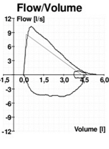 Graphical demonstration of various lung volumes. Image obtained from http://commons.wikimedia.org/wiki/File:Lungvolumes.svg.