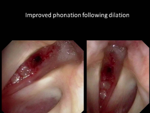 Slide6 