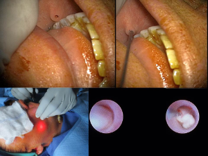 Slide6