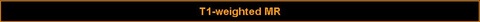 T1-weighted MR