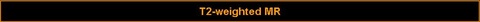 T2-weighted MR.jpg T2-weighted MR