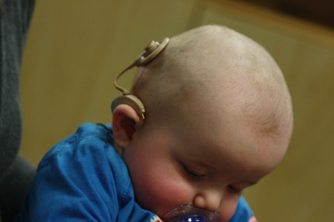 A Baby with A Cochlear Implant A Baby with A Cochlear Implant