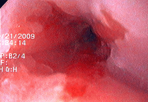 ge%20junct%20a.gif ge%20junct%20a