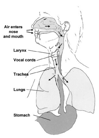 laryngectomy01_0.gif