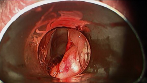 surg10