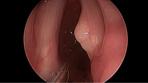 surg2