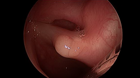 surg3