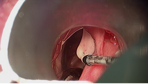surg5