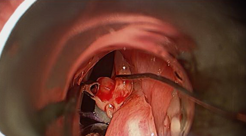 surg7