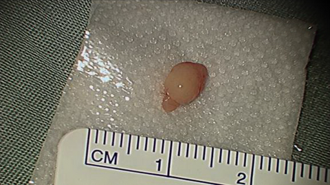 surg8