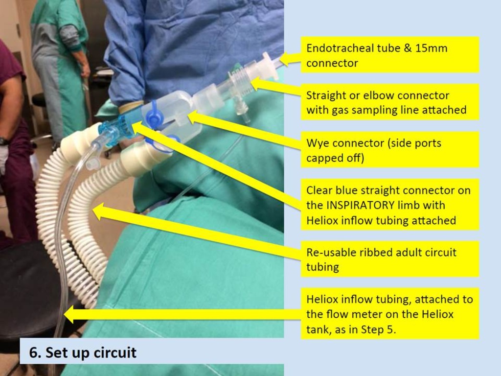 Heliox Setup for the Difficult Airway | Iowa Head and Neck Protocols ...