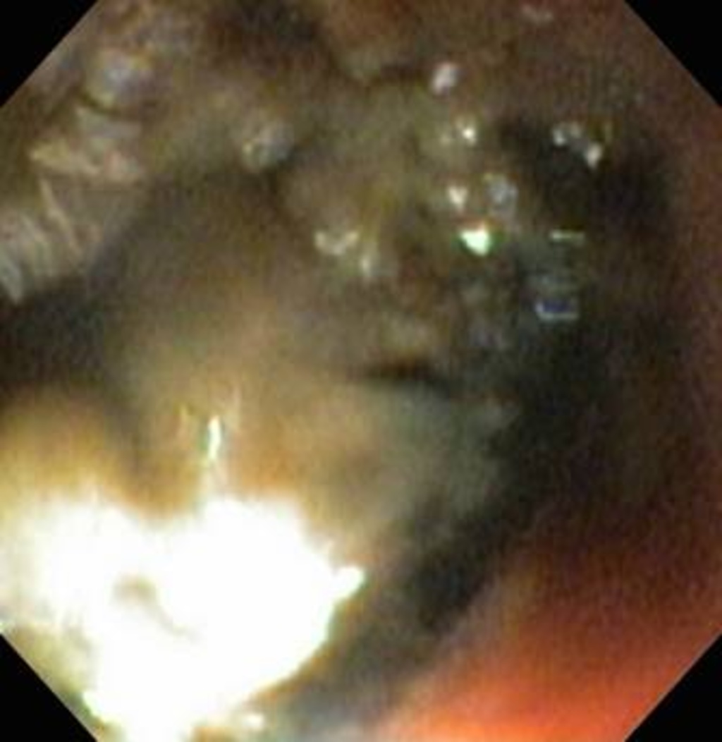 Genshin Impact Characters That Have Never Had A Rerun