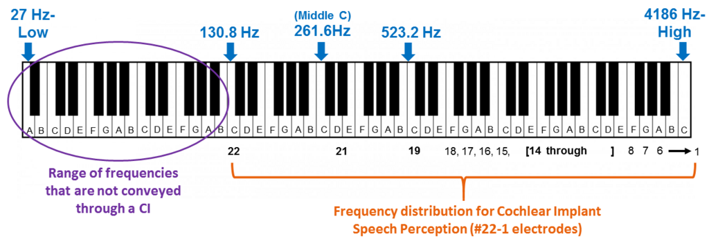 Low Frequency with a Cochlear Implant Low Frequency with a Cochlear Implant