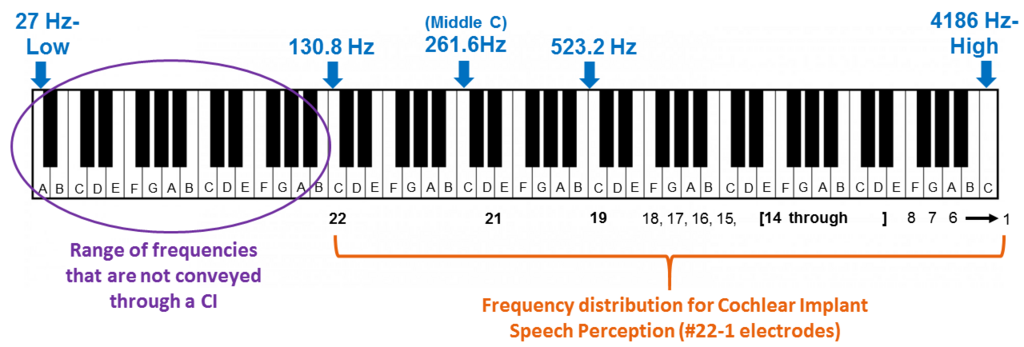 Low frequency with cochlear implant Low frequency with cochlear implant
