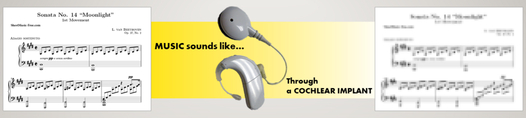 Music sounds through a Cochlear Implant