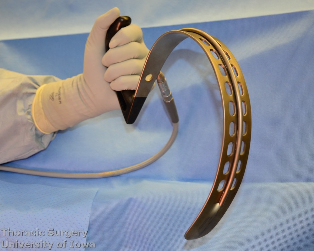 Arshava illuminated transhiatal retractor was developed for better exposure of the mediastinum during esophagectomy