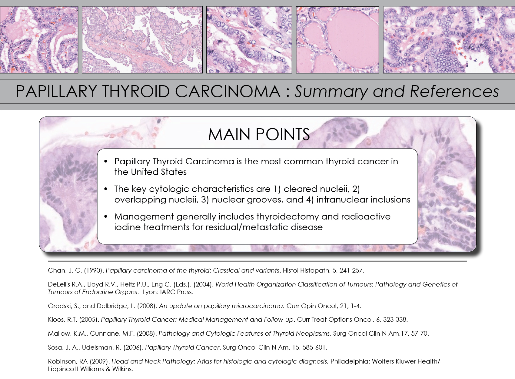 Papillary Thyroid Carcinoma | Iowa Head and Neck Protocols - Carver ...