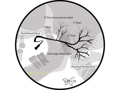 Classification of Salivary Duct Stenosis (Parotid Duct Stricture ...