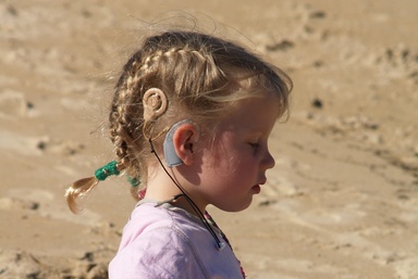A Girl With a Cochlear Implant A Girl With a Cochlear Implant