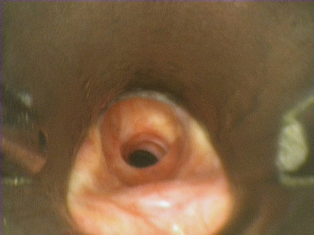  initial exposure