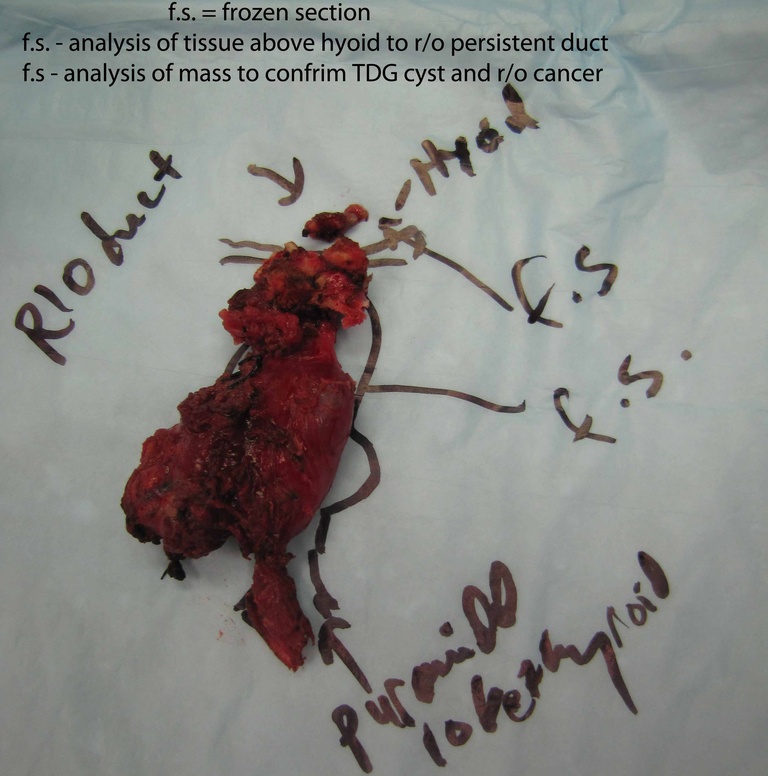 0020%20resected%20specimen%20labelled.jpg