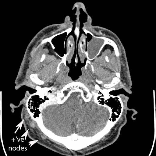 002CT1labelled.jpg