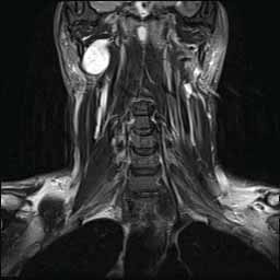 002mri.jpg