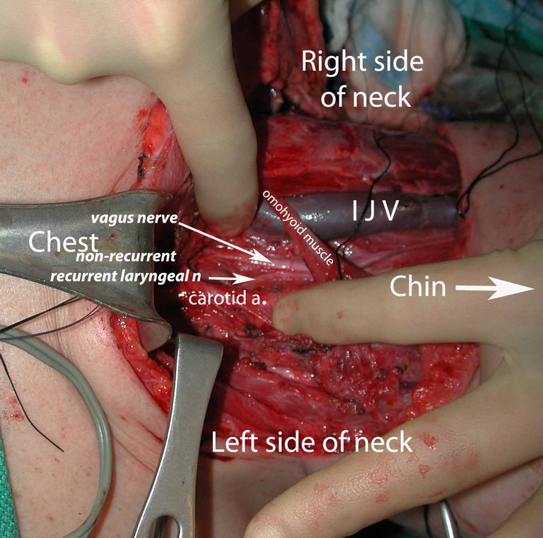 0042 nr rln annotated.jpg