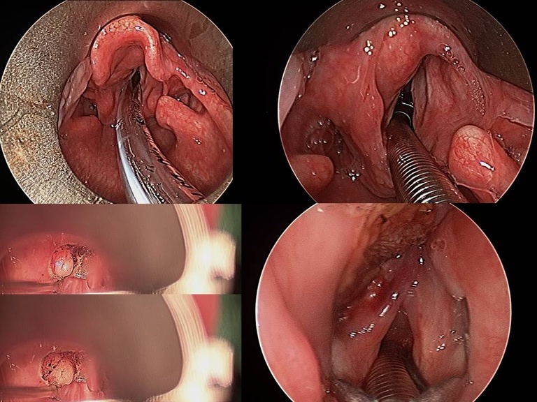 005%20surgery.jpg