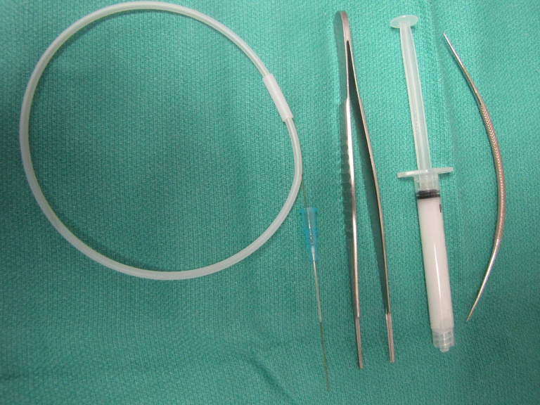 Note that we currently use the 0.015 guidewire in the picture rather than 0.018 teflon coated guidewire used previously