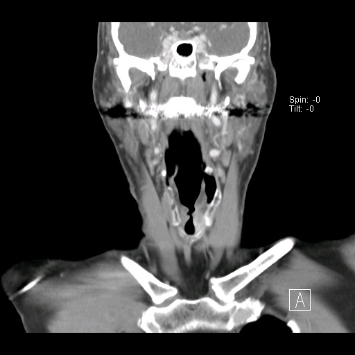 009%20coronal.jpg