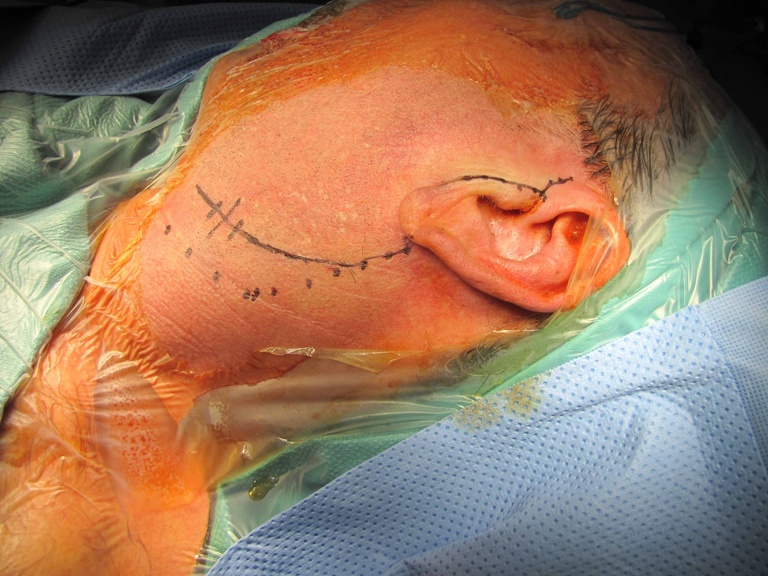 01%20parotid%20a.jpg