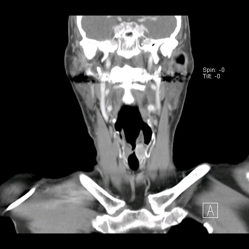 010%20coronal.jpg