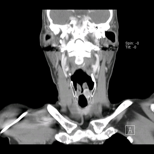 011%20coronal.jpg