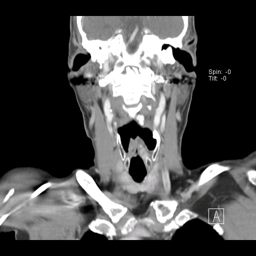 012%20coronal.jpg