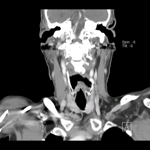 013%20coronal.jpg