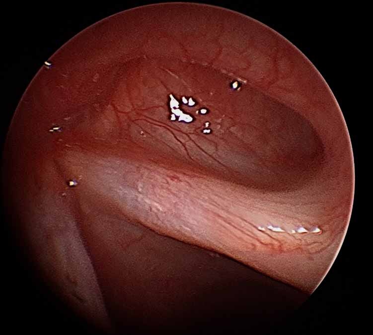 016%20sulcus.jpg