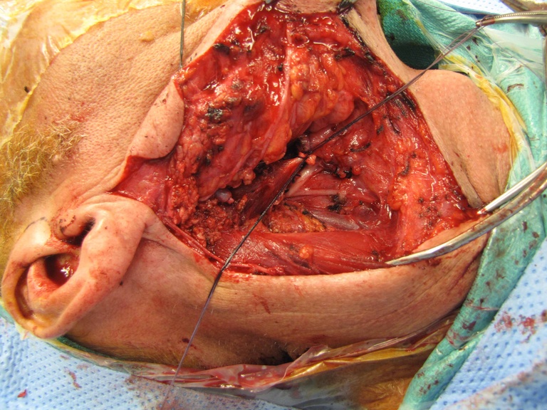 016surg.jpg