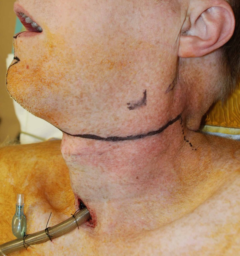02%20design%20incision.jpg