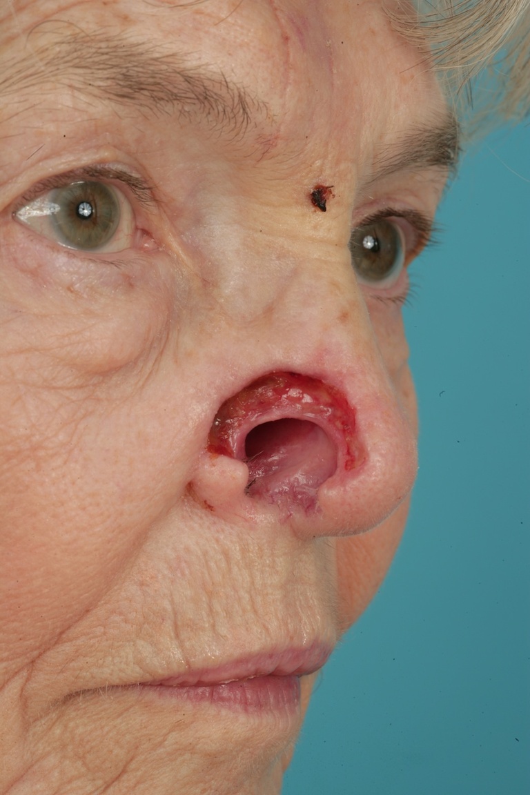   Preop Close up lateral view 