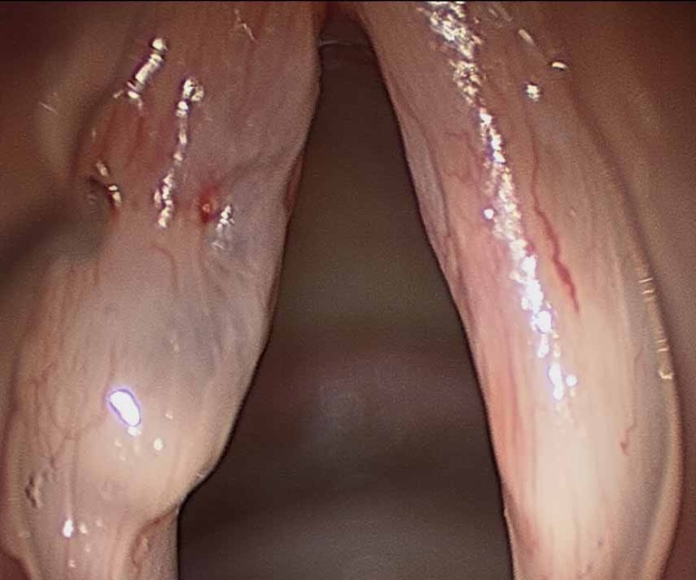 024%20sulcus.jpg