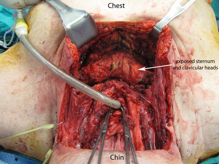 025%20medtrach.jpg