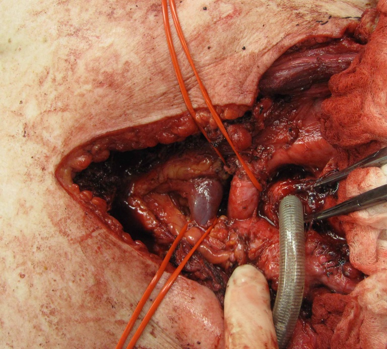 028%20medtrach.jpg