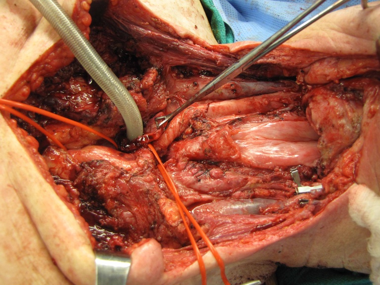 030%20medtrach.jpg