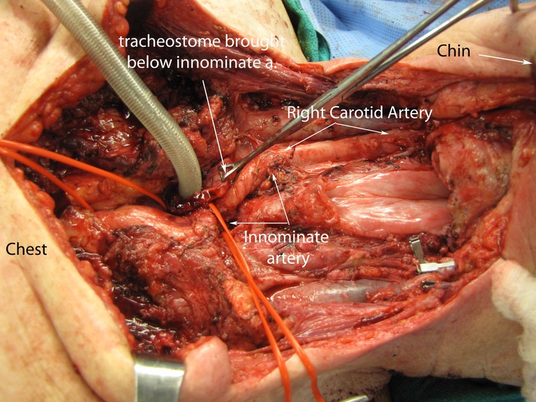 031%20medtrach.jpg