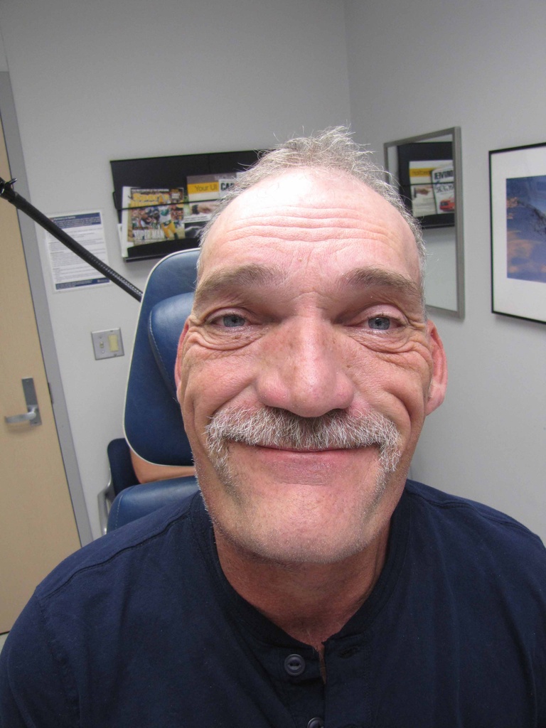 POD#8 with facial nerve function intact